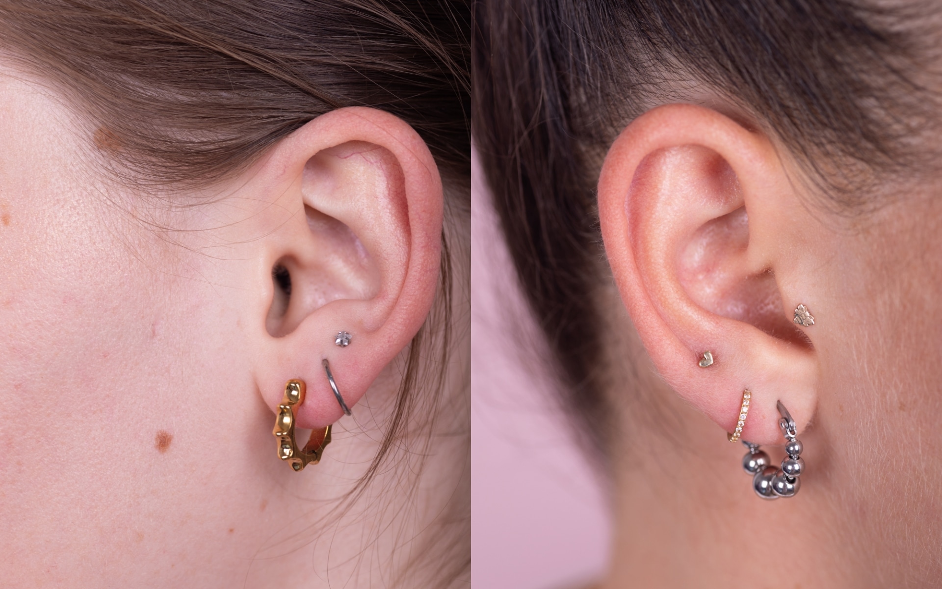 Lobe